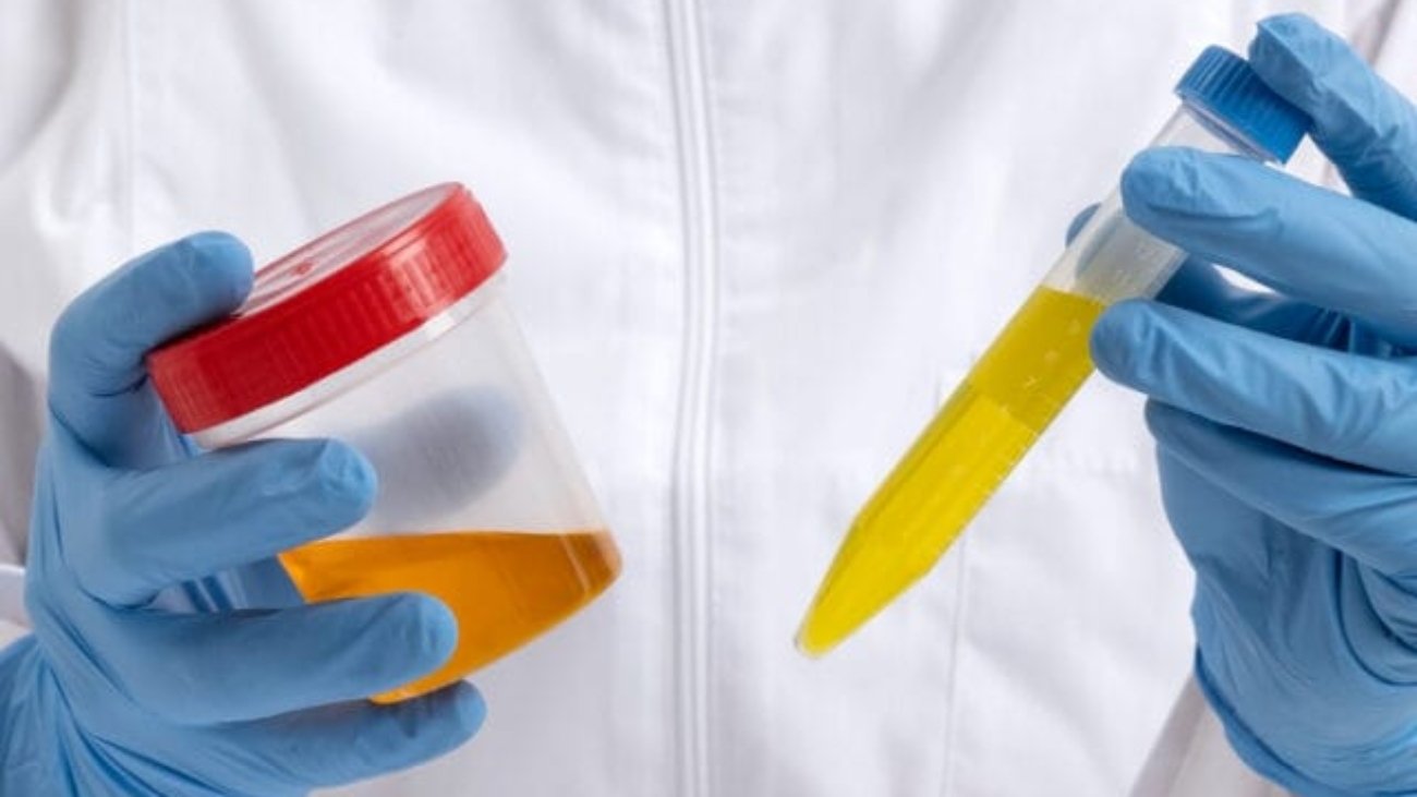 Chlamydia-And-Gonorrhea-Symptoms-Prevention-&-Treatment