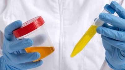 Chlamydia-And-Gonorrhea-Symptoms-Prevention-&-Treatment