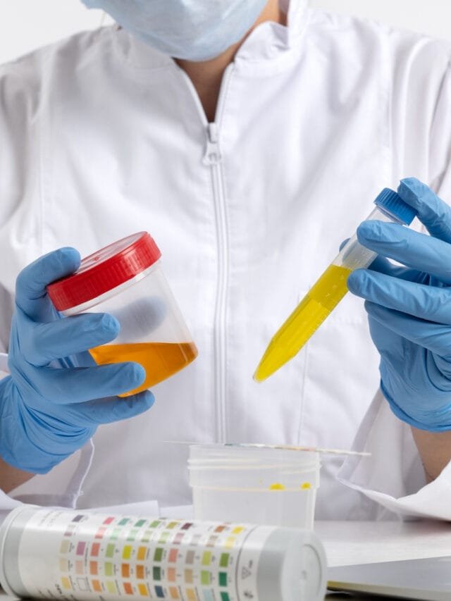 Chlamydia And Gonorrhea Symptoms (Prevention & Treatment)