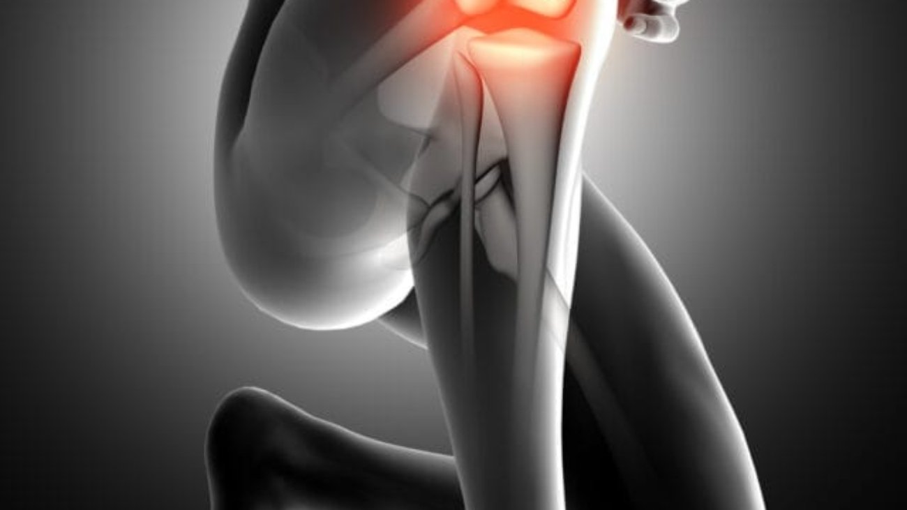 Knee-Pain-3D-Image