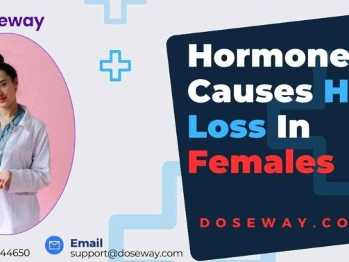 Which-Hormone-Causes-Hair-Loss-In-Females
