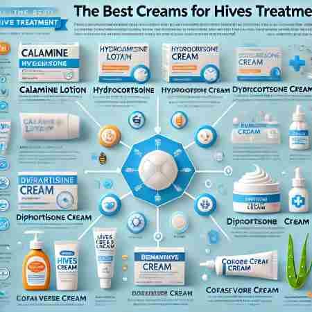 Over The Counter Antihistamine For Hives (Causes And Symptoms) 6 Best-Creams-For-Hives