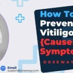 How-To-Prevent-Vitiligo