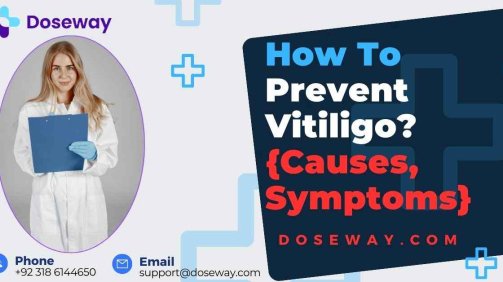 How-To-Prevent-Vitiligo