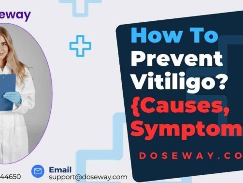 How-To-Prevent-Vitiligo