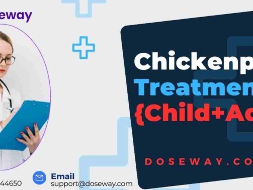 Chickenpox-Treatment-Antivirals-To-Supportive-Care