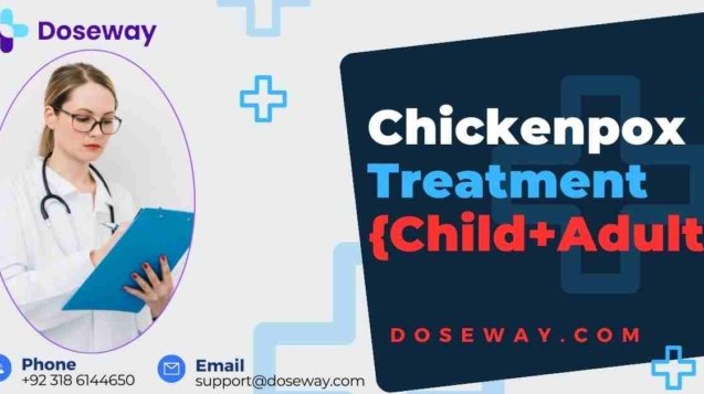 Blog 25 Chickenpox-Treatment-Antivirals-To-Supportive-Care