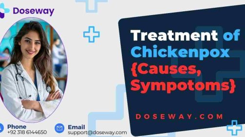 Top-10-Best-Antibiotics-For-Chickenpox