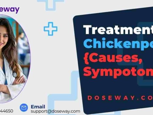 Top-10-Best-Antibiotics-For-Chickenpox