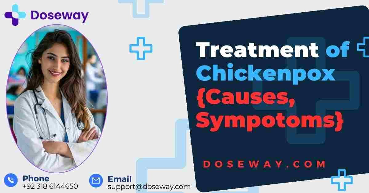 7 Best Antibiotics For Chickenpox (For Fast Recovery) 2 Top-10-Best-Antibiotics-For-Chickenpox