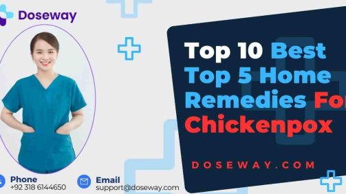 Top-5-Home-Remedies-For-Chickenpox