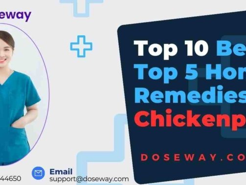 Top-5-Home-Remedies-For-Chickenpox