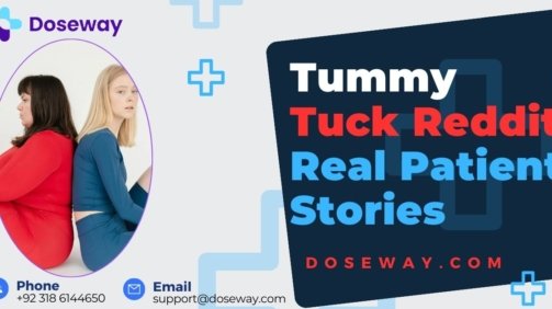 Tummy-Tuck-Reddit-Real-Patient-Stories-Analyzed