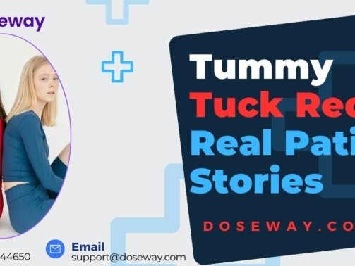 Tummy-Tuck-Reddit-Real-Patient-Stories-Analyzed