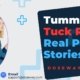 Tummy-Tuck-Reddit-Real-Patient-Stories-Analyzed