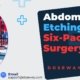 Ab-Etching-Cost