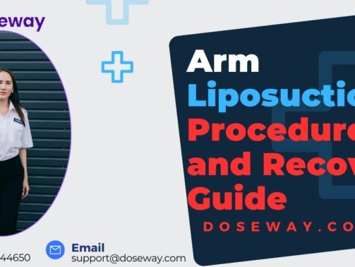 Arm-Liposuction