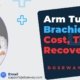 Arm-Tuck
