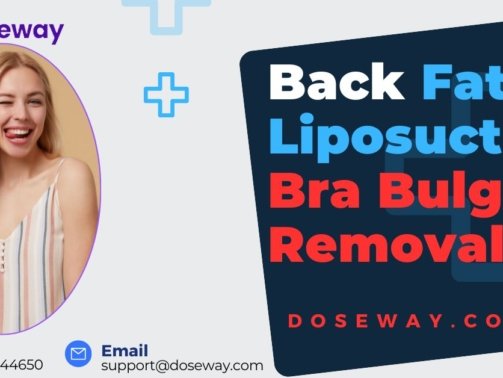 Back-Fat-Liposuction