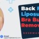 Back-Fat-Liposuction