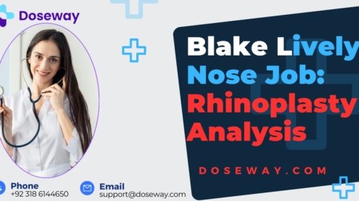 Blake-Lively-Nose-Job