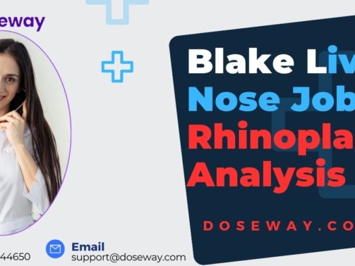 Blake-Lively-Nose-Job