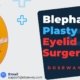 Blepharoplasty-Price