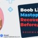 Boob-Lift