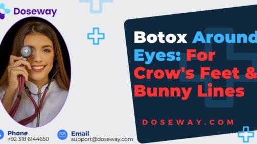 Botox-Around-Eyes