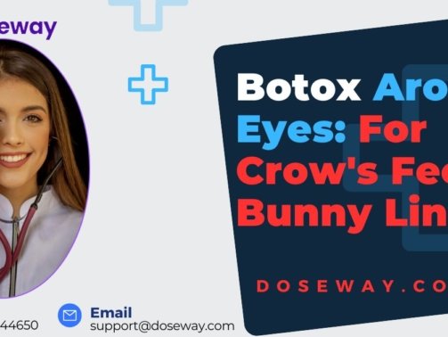 Botox-Around-Eyes