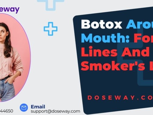 Botox-Around-Mouth