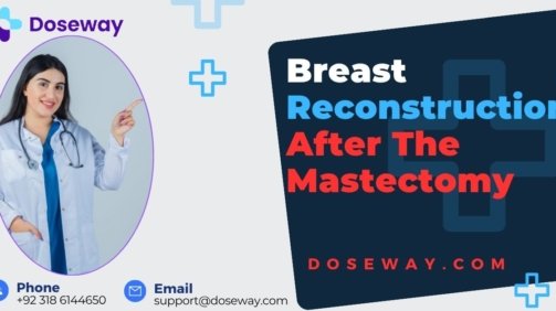Breast-Reconstruction-After-Mastectomy