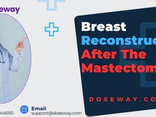 Breast-Reconstruction-After-Mastectomy