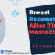 Breast-Reconstruction-After-Mastectomy