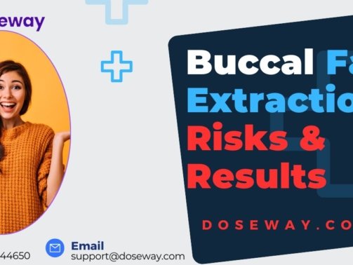 Buccal-Fat-Extraction