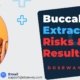 Buccal-Fat-Extraction