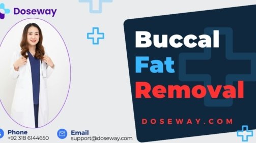 Buccal-Fat-Removal-Treatment