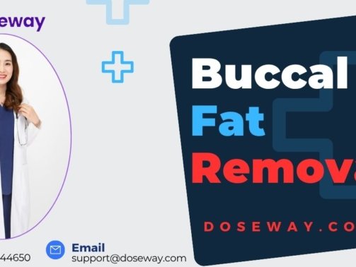 Buccal-Fat-Removal-Treatment