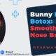 Bunny-Line-Botox-Nose.jpg