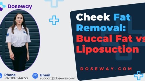 Cheek-Fat-Removal