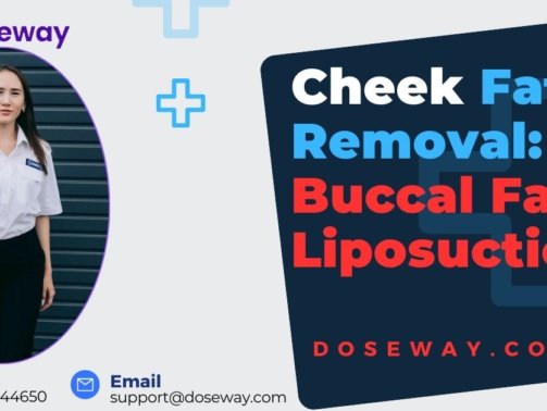 Cheek-Fat-Removal