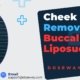 Cheek-Fat-Removal