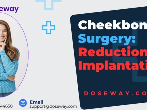 Cheekbone-Surgery