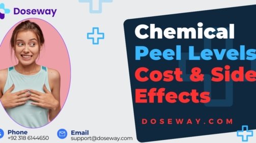 Chemical-Peel-Levels