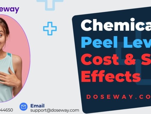Chemical-Peel-Levels