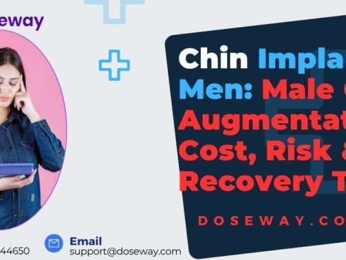 Chin-Implant-Men