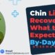 Chin-Lipo-Recovery