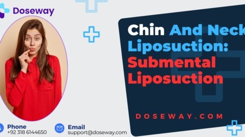Chin-and-Neck-Liposuction