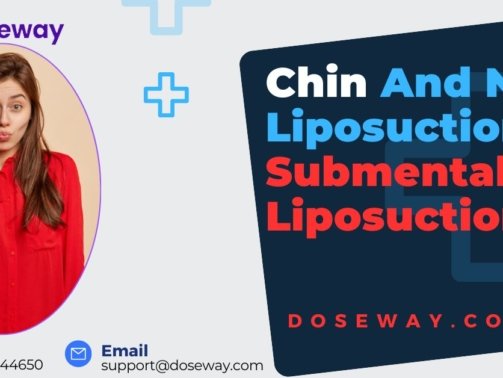 Chin-and-Neck-Liposuction