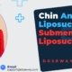 Chin-and-Neck-Liposuction